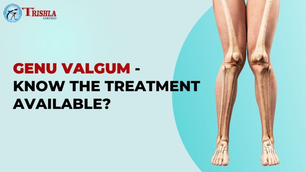 Knock Knees (Genu Valgum) -Treatment - Trishlaortho