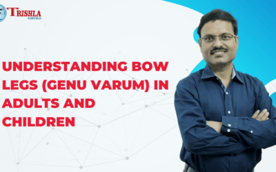 Understanding Bow Legs (Genu Varum)in Adults and Children