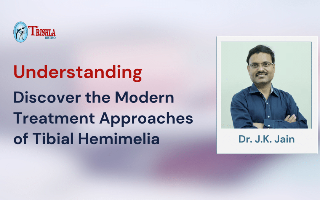 Discover the Modern Treatment Approaches of Tibial Hemimelia