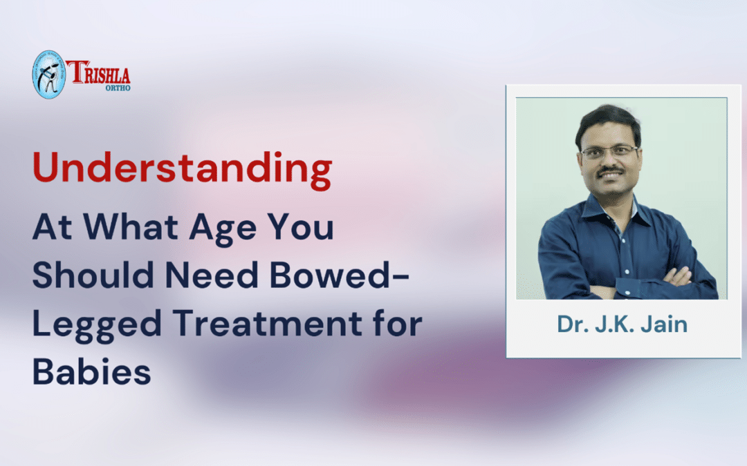 At What Age You Should Need Bow Leg Treatment for Babies