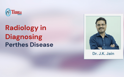 Radiology in Diagnosing Perthes Disease