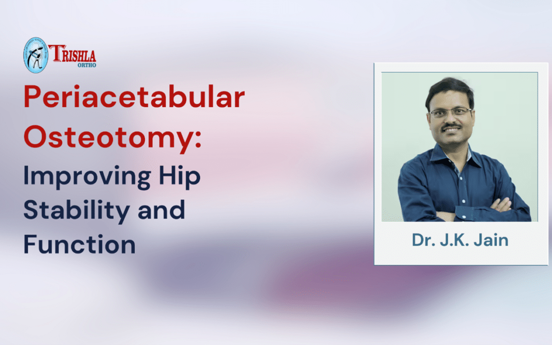 Periacetabular Osteotomy: Improving Hip Stability and Function