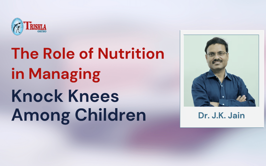 The Role of Nutrition in Managing Knock Knees Among Children