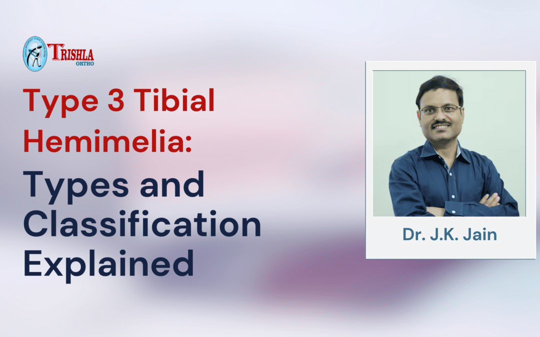 Type 3 Tibial Hemimelia: Types and Classification Explained