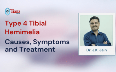 Type 4 Tibial Hemimelia: Causes, Symptoms, and Treatment